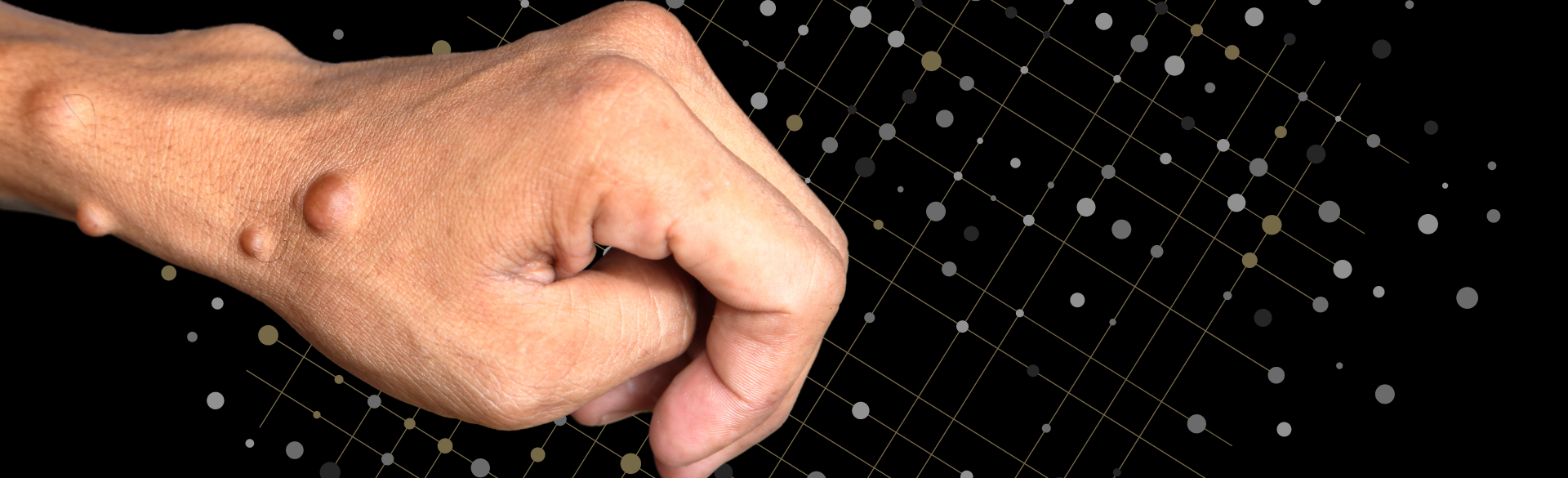 CU Data Scientists Developing Novel Mechanism to Expand NF1 Treatments