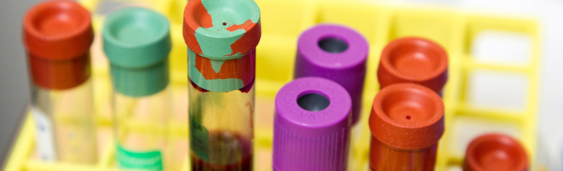 Test tubes