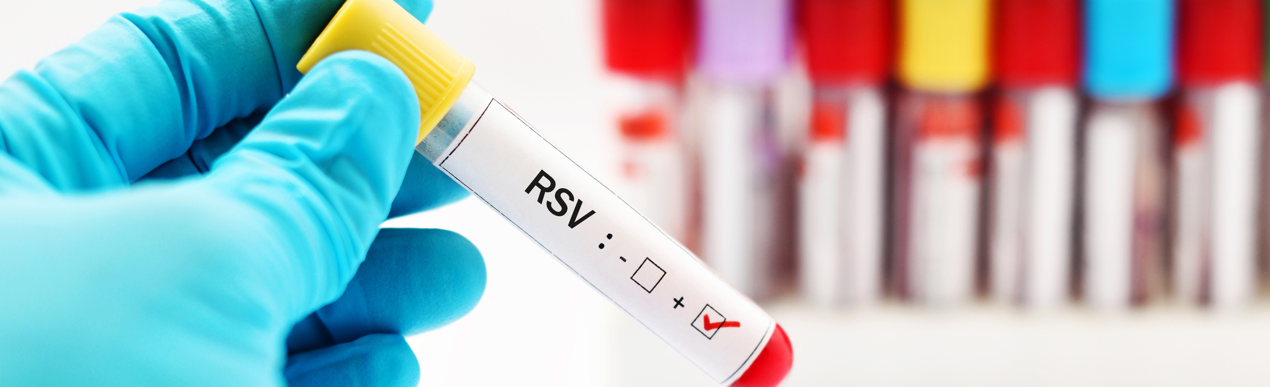 Gloved hand holding sample vial labeled 